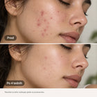 COSRX – Centella Blemish Cream pomirjujoča krema za nepravilnosti 30 g