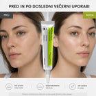 Celimax – The Vita A Retinal Shot Tightening Booster učvrstitveni booster z 0,1 % retinala 15 ml