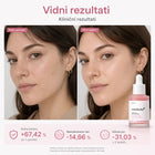 Medicube – PDRN Pink Peptide Serum učvrstitveni serum s PDRN in peptidi 30 ml